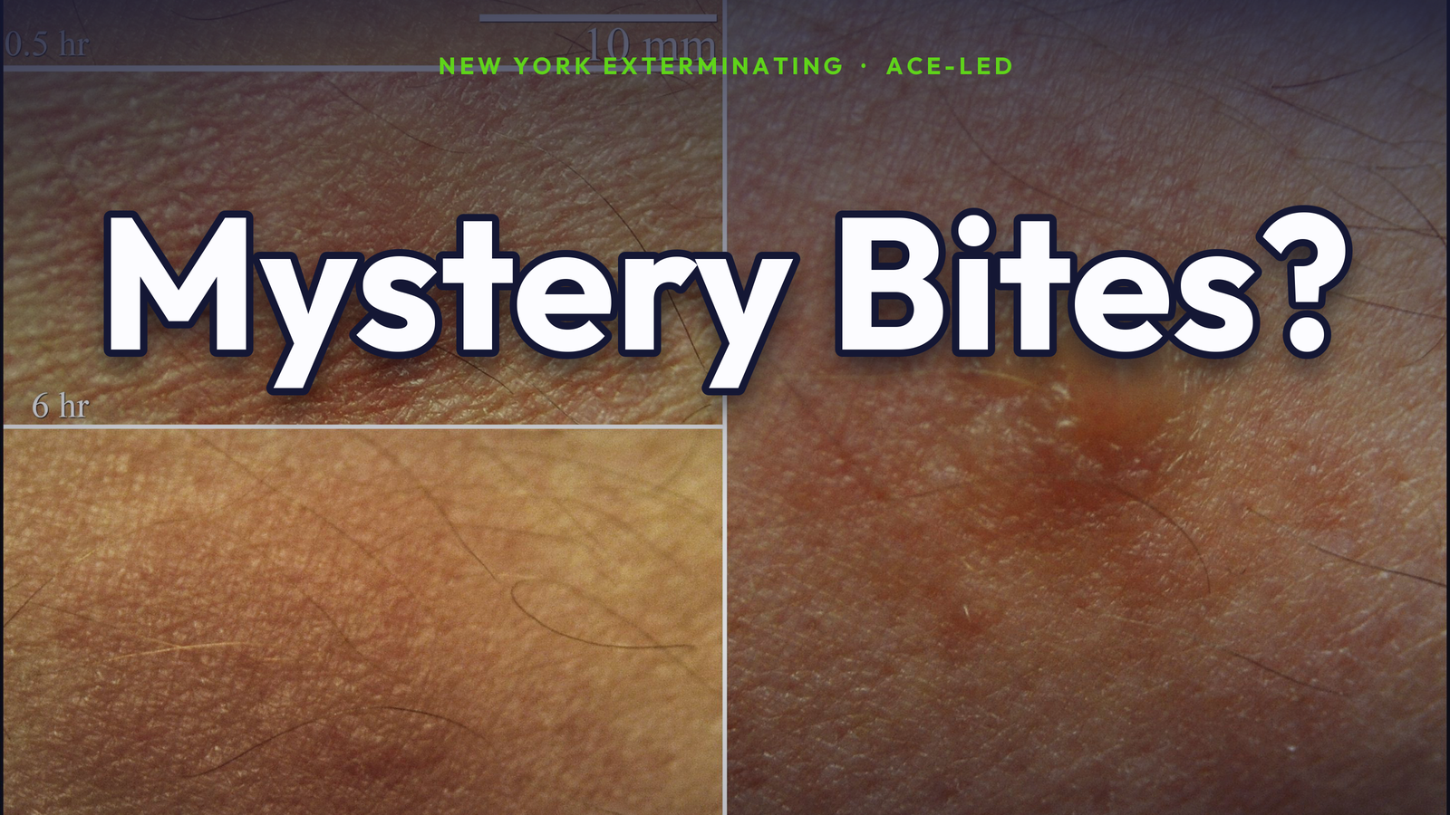 Mystery bites with no bug found — NYC ACE guide.