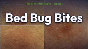 What bed bug bites look like — NYC ACE guide.