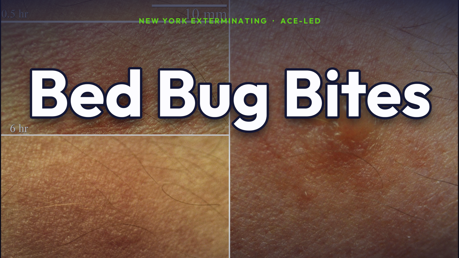 What bed bug bites look like — NYC ACE guide.