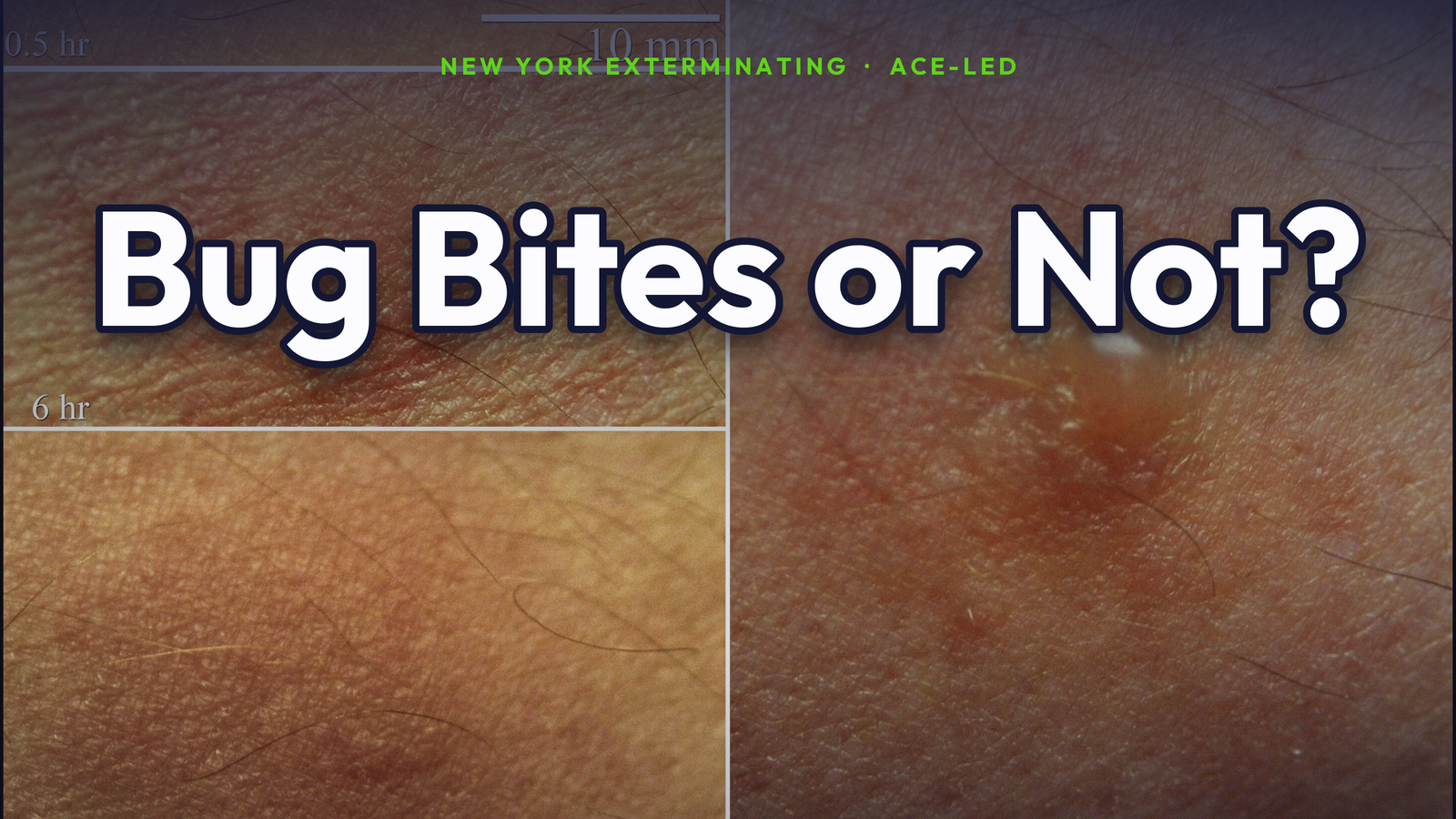 Bed bug bites or something else — NYC bite comparison by an ACE.