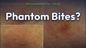 Phantom bug-bite identification guide for NYC apartments by an ACE.
