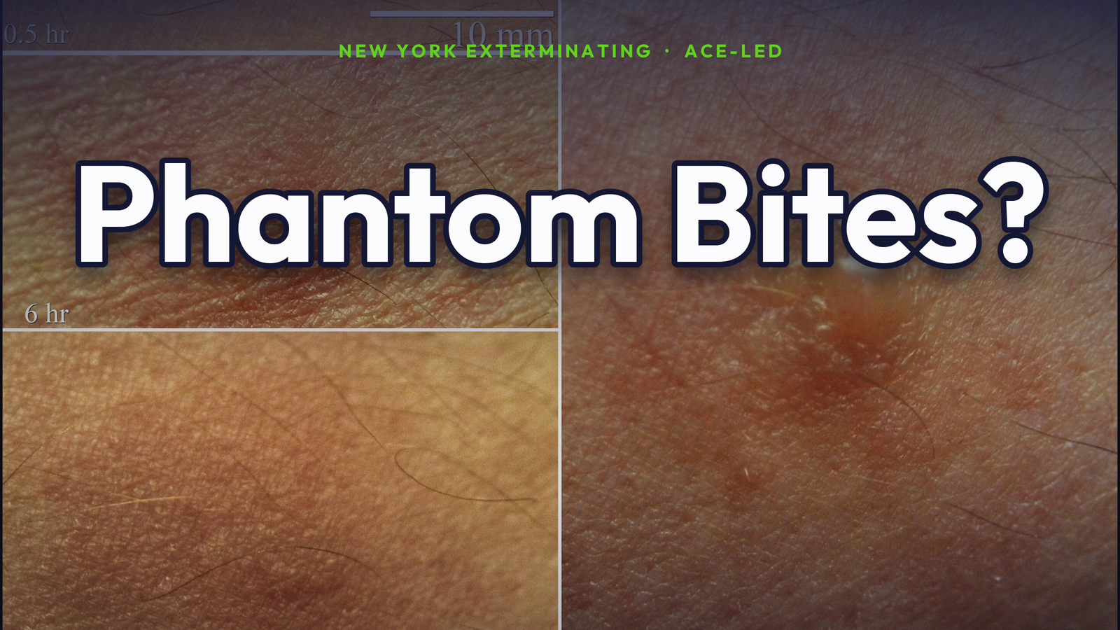 Phantom bug-bite identification guide for NYC apartments by an ACE.