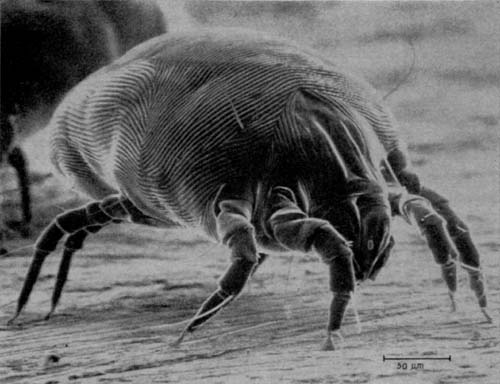 House dust mite under magnification